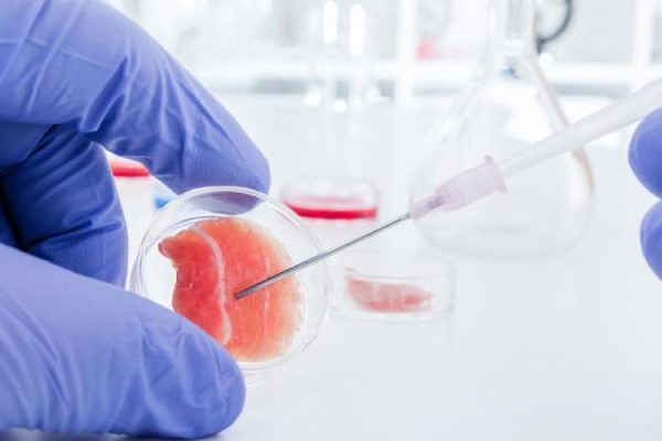 Terapi Stem Cell Jadi Topik Ramai di Perbincangkan Dalam Industri Kesehatan
